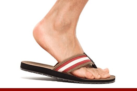 Foot Pain from sandals and flip flops