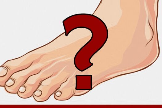 What the Difference between Warts and Calluses?